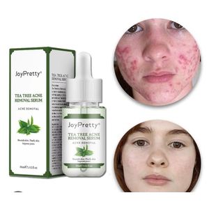 Joy Cool Tea Tree Acne Removal Serum Acne Blackhead Essence Shrink Pores Oil Control Whitening Moisturizing Firm Skin Facial Care