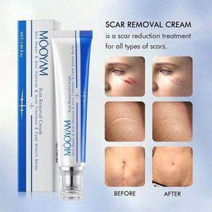 MOOYAM Skin Repair And Scar Acne Stretch Mark Removal Cream
