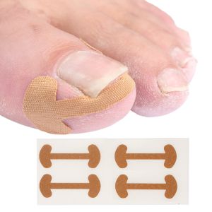 Gel Toe Stretchers and Toe Separators Kit (2 Pairs+ 1 Pouch)