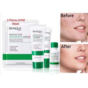 BIOAQUA Nourishing 5 Pieces Acne Treatment Salicylic Acid Kit, 2 Pieces Face Mask + Face Salicylic Cleanser +Salicylic Essence Serum + Salicylic 20g Cream