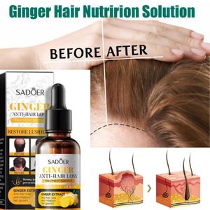 SADOER Nourishing Anti Hair Loss Treatment Essence, Hair Growth Ginger Extract Beard Growth,Hair Growth, Anti Dandruffs Hair Moisturizing Hair Care Serum, Derma Roller compliment in Anti Hair Loss