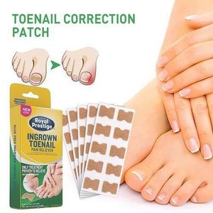 50pcs/Box Ingrown Toenail Sticker Toenail Correction Patch Tools Kit Nail Foot Tool Toe Nail Fingernail Care Tool - Royal Prestige