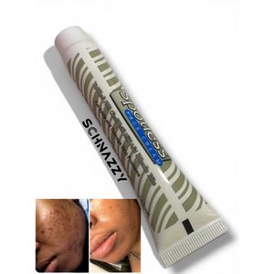 Spotless Cream for Teenage Spots Pimple Acne - with Lactic and Lime Juice