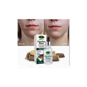 Aichun Beauty   Licorice Root Anti Inflamatory Facial Serum
