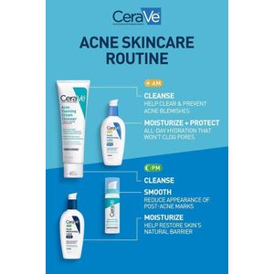 cerave.Acne Foaming Cream Cleanser + AM Facial Moisturizing Lotion SPF 30 + PM Facial Moisturizing Lotion + Resurfacing Retinol Serum – Complete 4-IN-1 Acne & Texture Repair Set