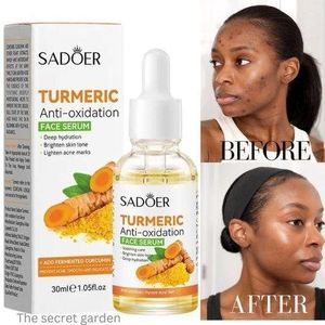 SADOER Dark Spots Remover Tumeric Serum Acne Clear Oil Control Blemish Remover