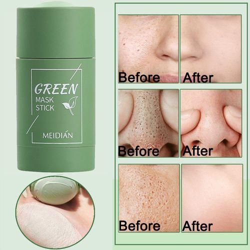 product_image_name-Beauty-Green Mask Stick Facial Mask For Black Spots And Pimples-4