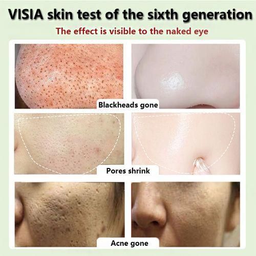 product_image_name-Beauty-Green Mask Stick Facial Mask For Black Spots And Pimples-5