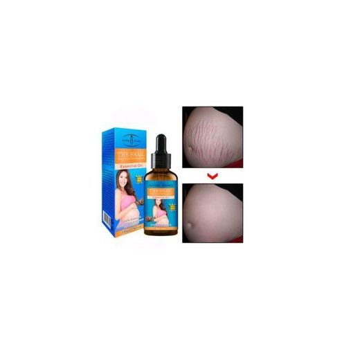 product_image_name-Aichun Beauty- Snail Removes Stretch Marks Essential Oil 30ml-1