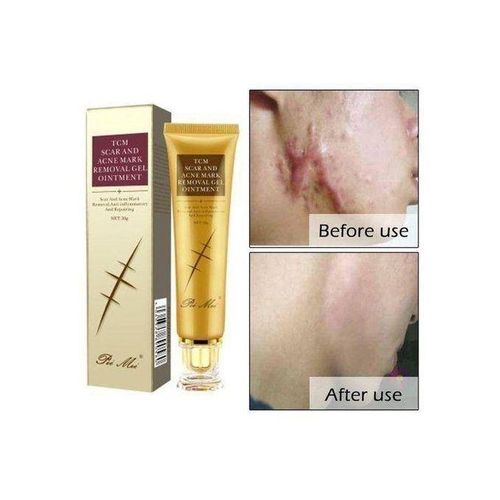 product_image_name-TCM-Scar, Acne, Stretch Mark Remover Cream-1