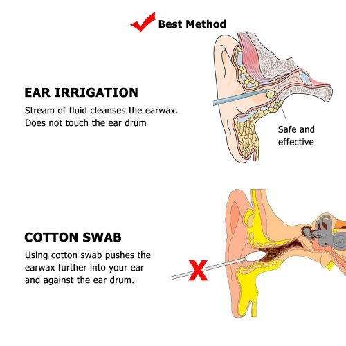 Generic 500ML Ear Irrigation Cleaning Kit Wax Removal Kit ...
