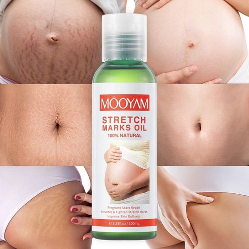 product_image_name-Generic-Advanced Stretch Marks Removal Oil Stretch Marks Oil Remover-1