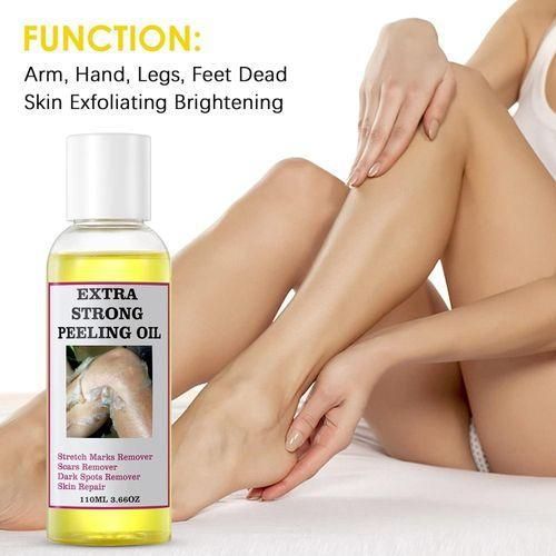 product_image_name-MOOYAM- Extra Strong Peeling Oil Elbows Knees Hands Even Complexion-1