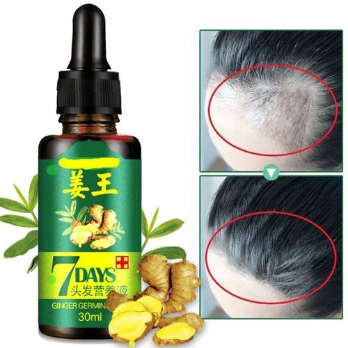 O Carly Hair Growth Serum For Men Women 7days Tonic Ginger Germinal Oil Best Price Online Jumia Kenya