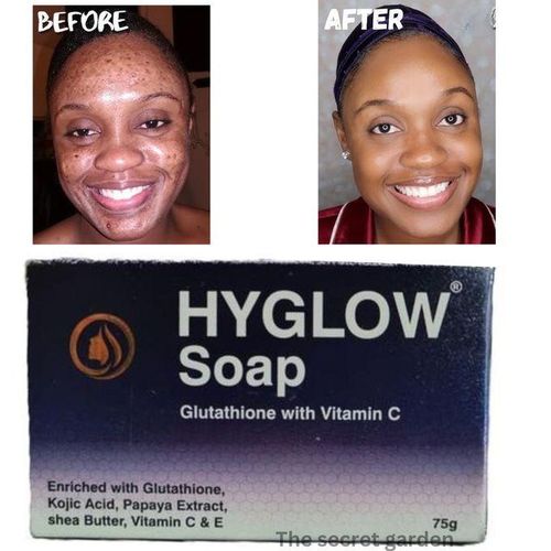hyglow glutathione review Generic with Vitamin C Soap 75g @ Best nem bac t testing for Choose Quantity::20LBS (save $10.00)