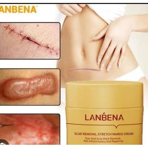 product_image_name-Lanbena-Scar And Stretch Marks Removal Cream-1