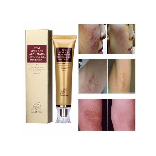 tcm scar and acne mark removal gel ointment price
