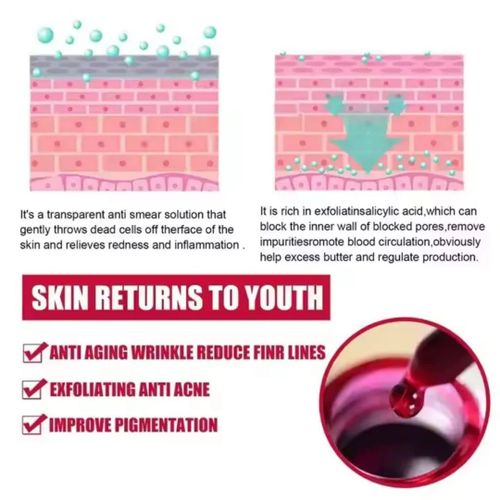 product_image_name-MOOYAM-Natural Organic AHA 30% BHA 2%  Exfoliating  Solution-6