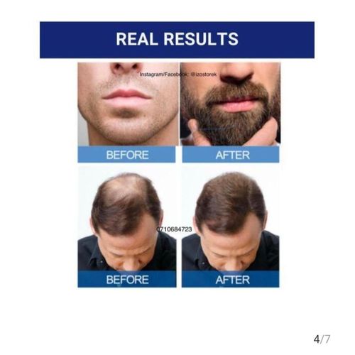 product_image_name-Kirkland-Signature Minoxidil 5% Topical Solution - Extra Strength Hair Regrowth Treatment for Men - 60ml (1 Month Supply)-4