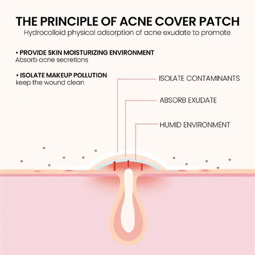 product_image_name-Generic-Repair Acne Patch Facial Skin Care Fade Blemishes Pimple Marks Closed Acne Blemishes Cover Acne Pimple Repair Patch-4