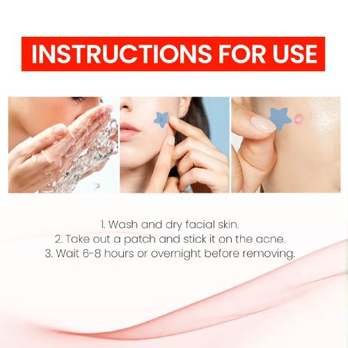 product_image_name-Generic-Repair Acne Patch Facial Skin Care Fade Blemishes Pimple Marks Closed Acne Blemishes Cover Acne Pimple Repair Patch-6