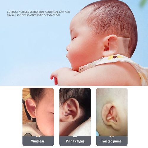 Infant Ear Corrector Baby Ear Tape with Locator Ear Aesthetic