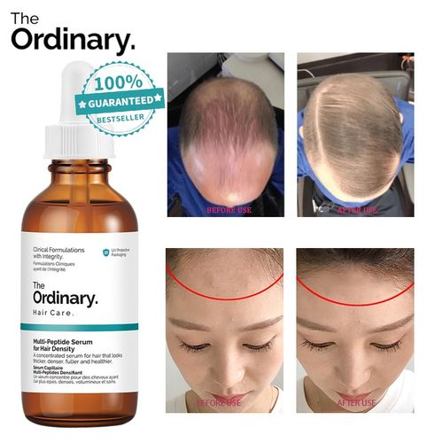 The Ordinarys MultiPeptide Serum for Hair Density  Canadian Beauty
