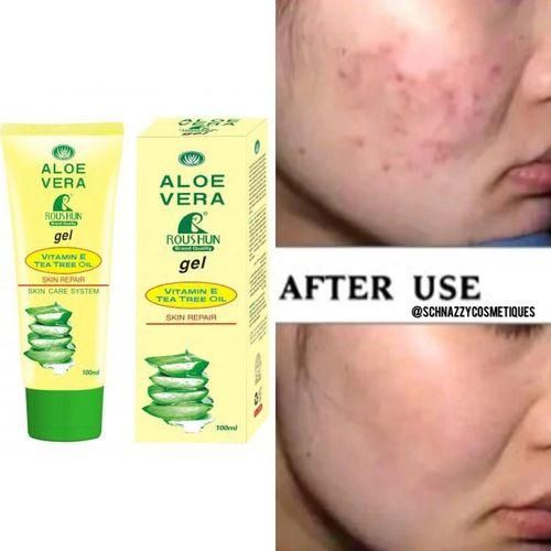 product_image_name-Roushun-Skin Repair Gel - Aloe Vera Vitamin E Tea Tree Oil 100ml-1