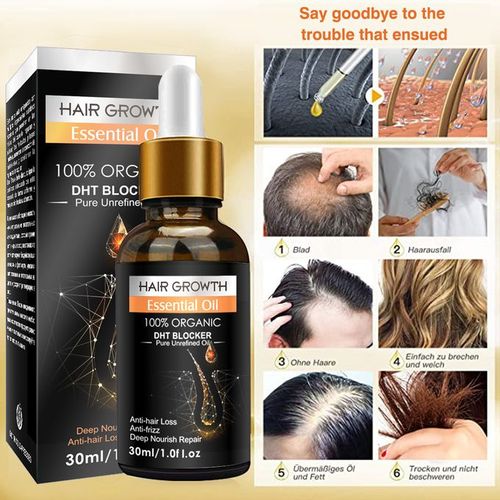 Biotin Hair Growth Essential Oil Biotin Cold-Pressed DHT Blocker @ Best ...