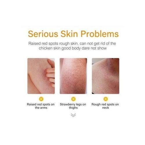 product_image_name-MOOYAM-Strawberry Legs Cream – Smooth & Bright Legs Moisturizer-5