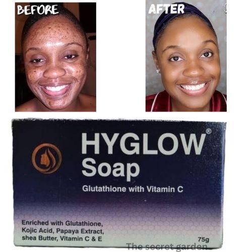 hyglow glutathione review Tablets not only boost immunity but also improve energy levels while having the master antioxidant, Glutathione! . . . #skin #skincare #smoothskin #ageless #healthyskin #skincareproducts #youngskin #youngerlookingskin #looseskinsolution #age Hyglow Cream with Glutathione Reviews