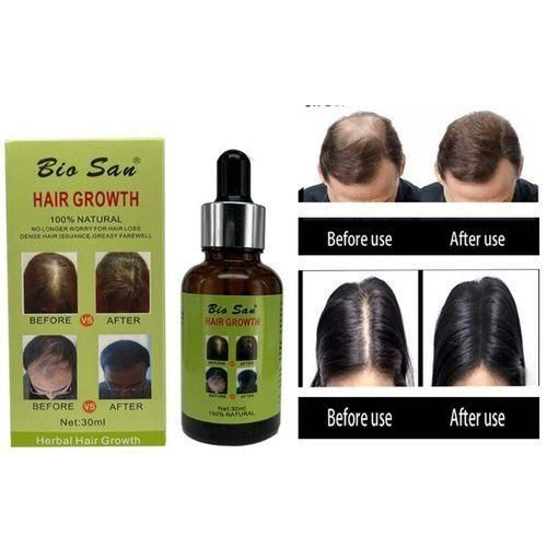 product_image_name-Generic-100% Natural Hair Growth Oil, Repair & Activation-1