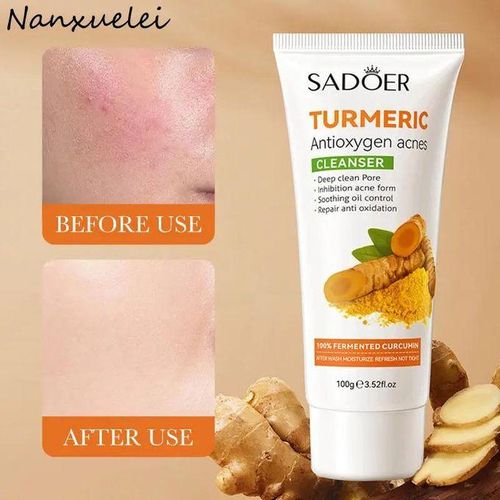product_image_name-SADOER-2 In 1  Turmeric Serum + Turmeric Facial Cleanser, Turmeric Cleanser and Turmeric Serum Moisturizes, prevents Acnes, Lightes, Smoothen, Cleanses and Brighten Skin, Can add Vitamin C for bright skin-3