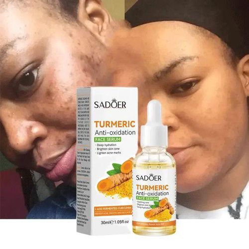 product_image_name-SADOER-2 In 1  Turmeric Serum + Turmeric Facial Cleanser, Turmeric Cleanser and Turmeric Serum Moisturizes, prevents Acnes, Lightes, Smoothen, Cleanses and Brighten Skin, Can add Vitamin C for bright skin-6