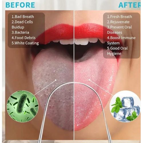 product_image_name-Fashion-Stainless Steel Tongue Coating Cleaner Tongue Scraper-4