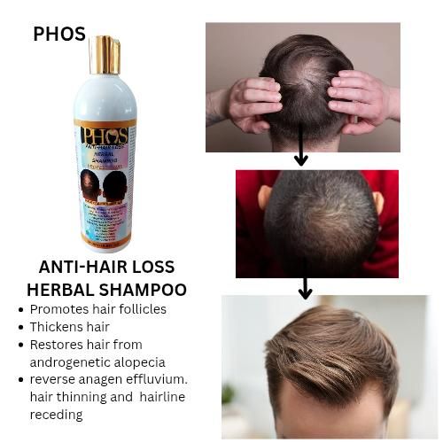 product_image_name-PHOS-ANTI-HAIR LOSS  SET  for MEN- Shampoo, Herbal Oil and Leave in Conditioner-6