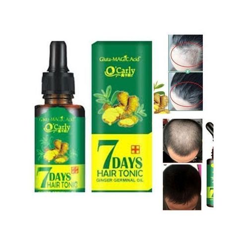 O'Carly Anti Hair Loss/ Baldness Growth Itchy Scalp Ginger Oil Best