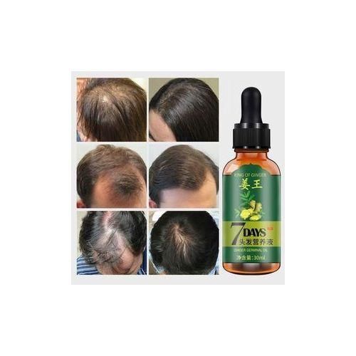 product_image_name-Nlee Beuty-Aichun Beauty Hair Growth Serum For Men&Women- 7days Tonic Ginger Germinal Oil-1