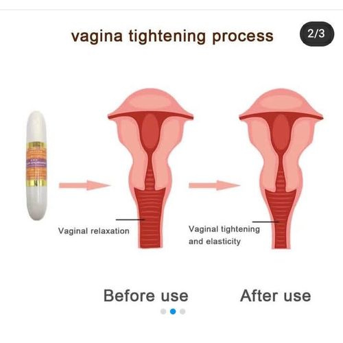 product_image_name-Generic-Premium Quality Vagina Tightening Wand (Medura Stick)-3
