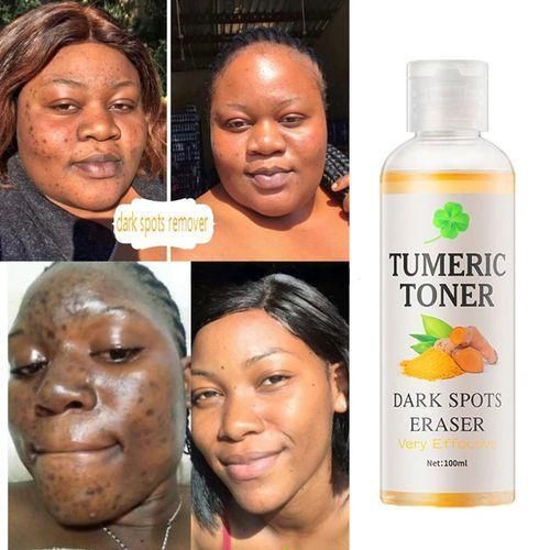 product_image_name-Generic-Dark Spots Corrector Melasma Remover Tumeric Serum Acne Remover-1