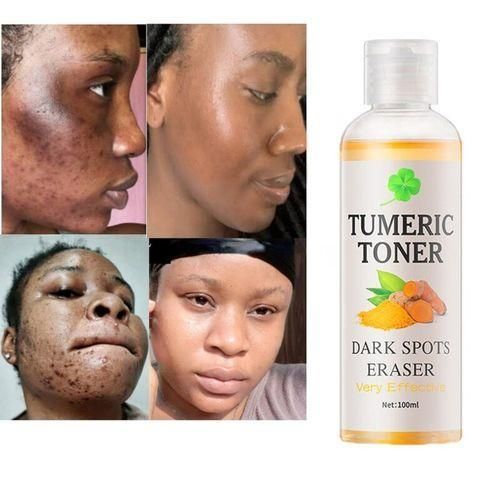 product_image_name-Generic-Dark Spots Corrector Melasma Remover Tumeric Serum Acne Remover-3