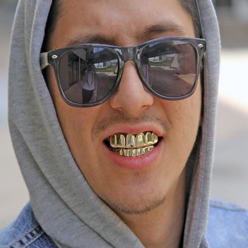 slugs gold teeth