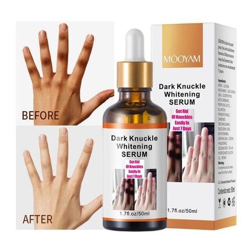 product_image_name-Generic-Dark  Knuckle Whitening Serum...-3