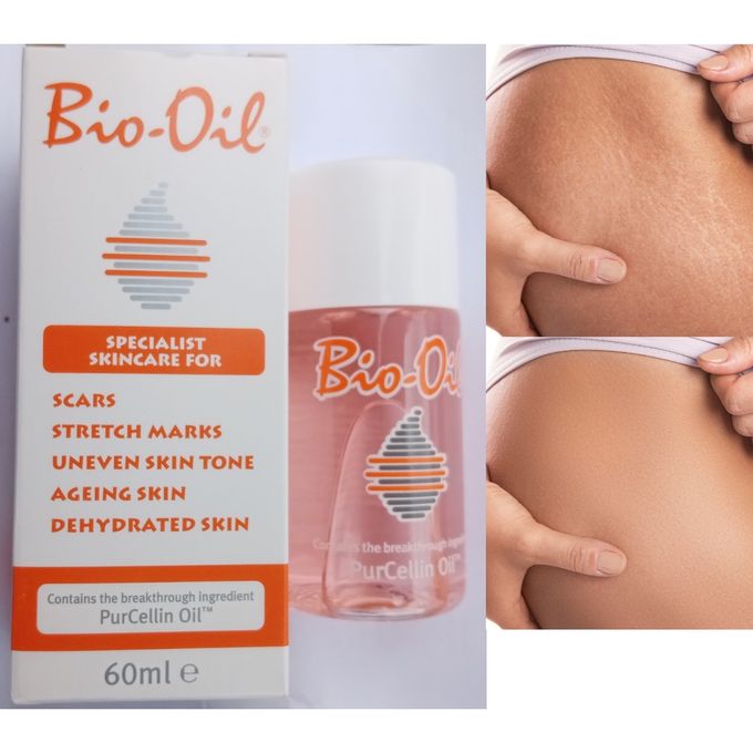 Beauty 5 In 1 Magical Stretch Marks Removal Oil Secret Ingredient Best Price Online Jumia Kenya