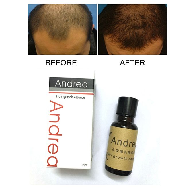 Andrea Natural Hair Growth Oil Best Price Online Jumia Kenya