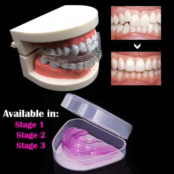 Generic 3in1 Hard And Soft Invisible Braces Smile