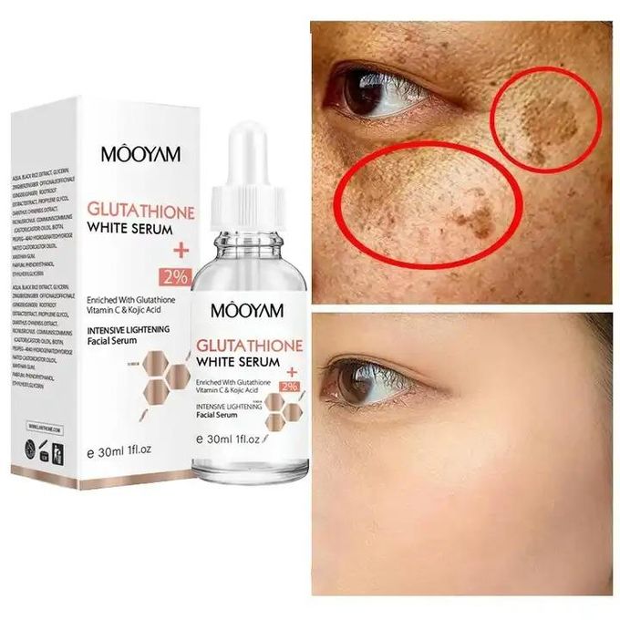 Generic Glutathione Serum - Whitening Dark Spot Corrector