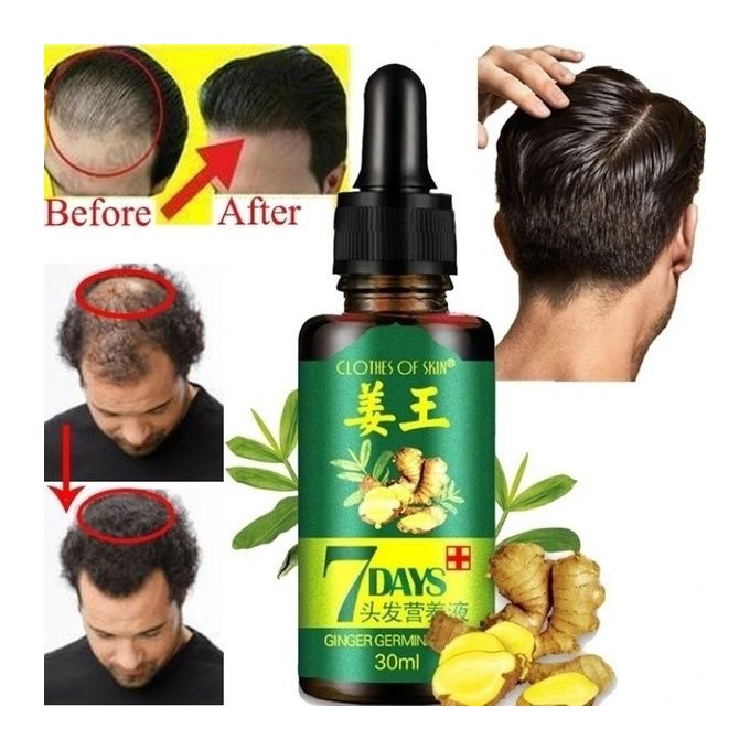 Hair Active Solution Hair Growth 7 Days Activator Hair Loss Oil