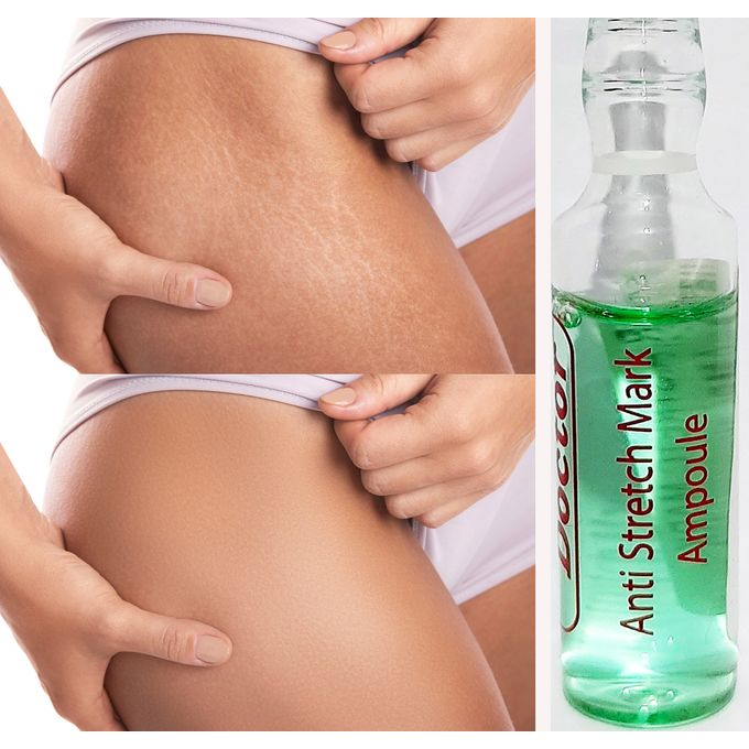 Herbal Skin Doctor Anti Stretchmark Body Ampoule Anti Aging Serum France Best Price Online Jumia Kenya