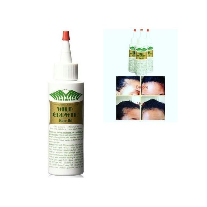 Wild Growth Hair Oil 118 Ml Best Price Online Jumia Kenya